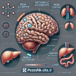 یماری‌های متابولیک ارثی، از جمله تجمع آهن در مغز و بیماری ویلسون