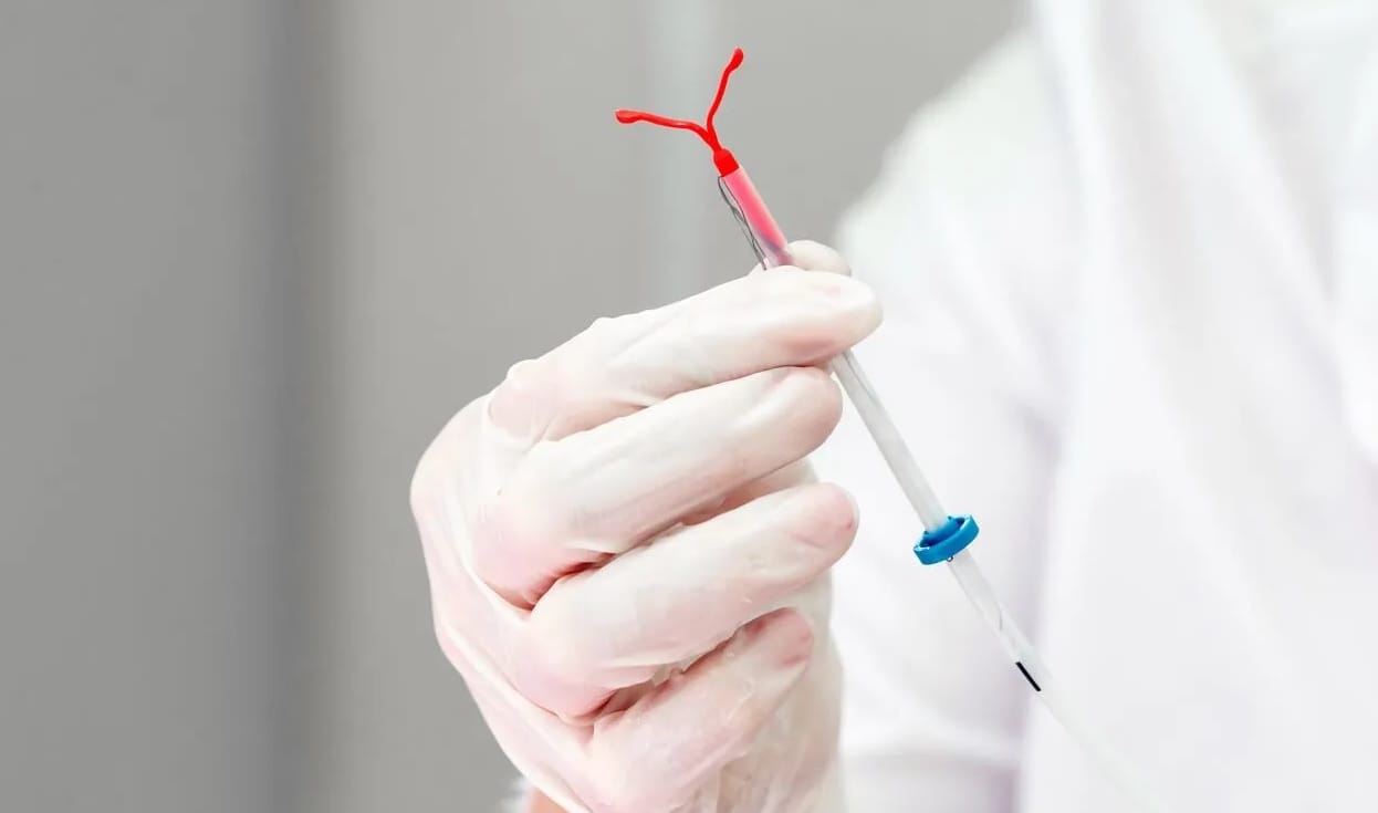 آیا IUD باعث افسردگی می‌شود؟